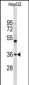 ELOVL2 Antibody (N-term)